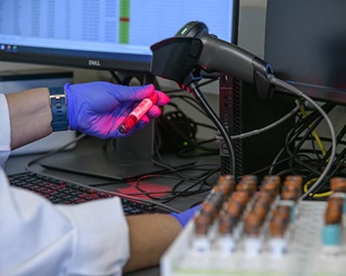 FDA Authorizes Use of UArizona COVID-19 Antibody Test; Testing Expanded to All Arizonans Age 18 and Older